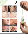 Skin Clarifying Salicylic Acid Serum for Acne Control - Cosmecell