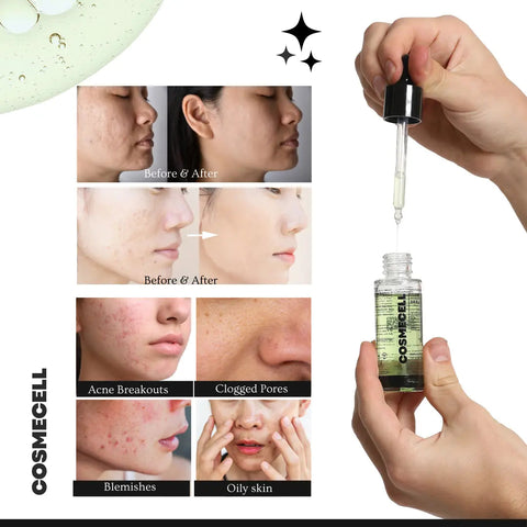 Skin Clarifying Salicylic Acid Serum for Acne Control - Cosmecell