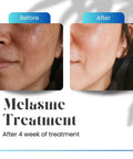 Hyperpigmentation Serum for Dark Spots Eraser and Radiant Skin - Cosmecell