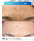 Hyperpigmentation Serum for Dark Spots Eraser and Radiant Skin - Cosmecell